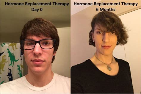 6 Months Hrt I Can See A Glimpse Of Myself For The First Time R Transtimelines