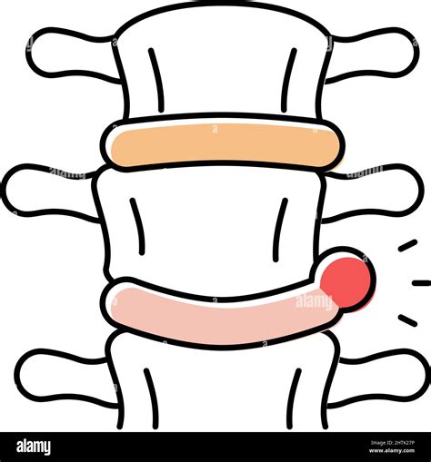 Ilustraci N Del Vector Del Icono De Color De La Enfermedad De Hernia