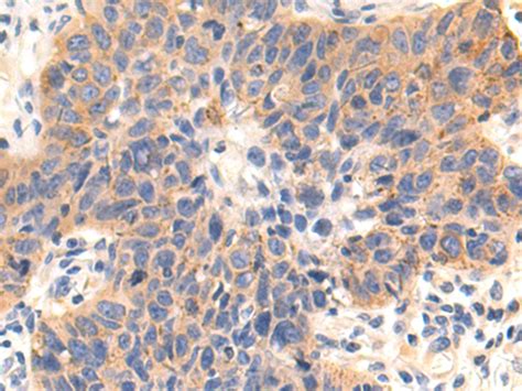 Arc Anti Arc Rabbit Polyclonal Antibody