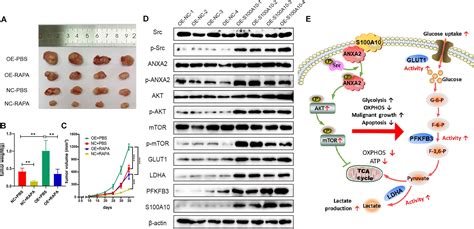 Frontiers S A Accelerates Aerobic Glycolysis And Malignant Growth