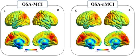 Frontiers Inherent Regional Brain Activity Changes In Male