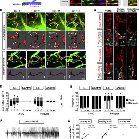 Impact Of Mural Cell Remodeling On Vessel Tonus And Blood Flow A