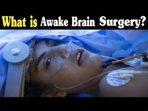 How Awake Brain Surgery Is Performed Awake Craniotomy D Animation