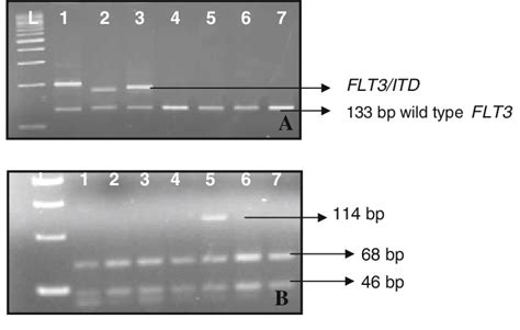 A Detection Of Flt Itd Mutations By Genomic Pcr Lane Shows