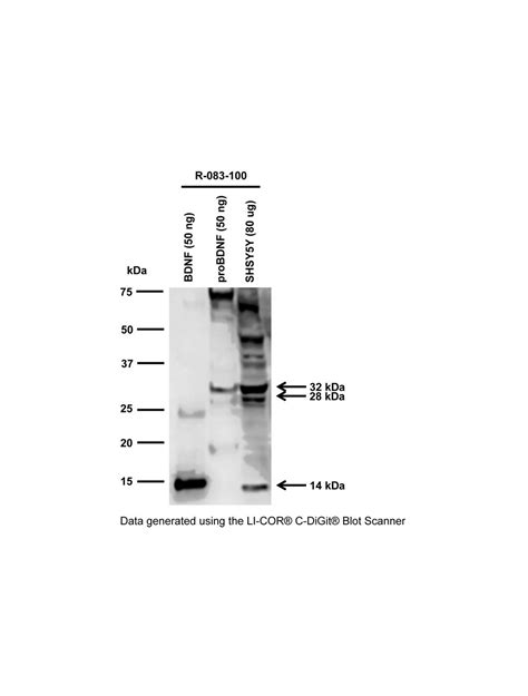 Brain Derived Neurotrophic Factor BDNF Rabbit Polyclonal Antibody