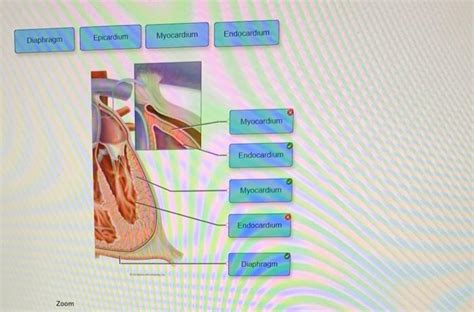 Solved Myocardium Endocardium Diaphragm Epicardium Chegg