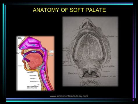 Palatal Lift Prosthesis Orthodontic Straight Wire Technique Ppt