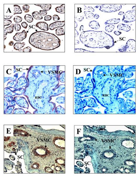 Immunolocalization Of Cyp27b1 And Vdr In Placental Chorionic Villi