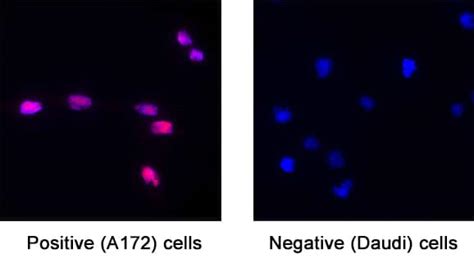 Human FGF Basic FGF2 BFGF Antibody MAB2332 100 R D Systems