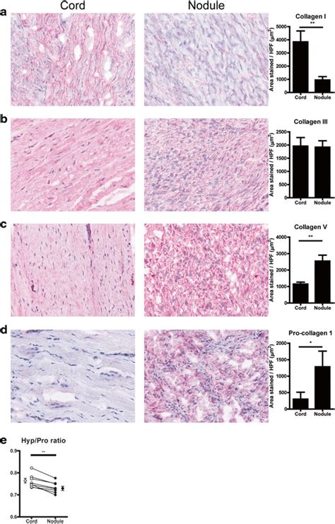 Collagenous Extracellular Matrix Proteins A Representative Pictures