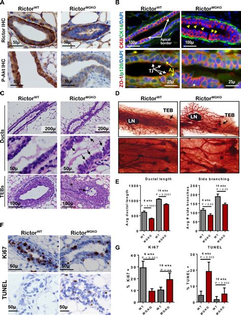 Loss Of Rictor Disrupts Mammary Branching Morphogenesis In Vivo A Ihc