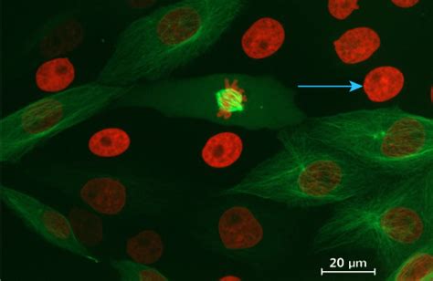 Calculer La Taille Dune Cellule Sur Une Photographie De Microscopie