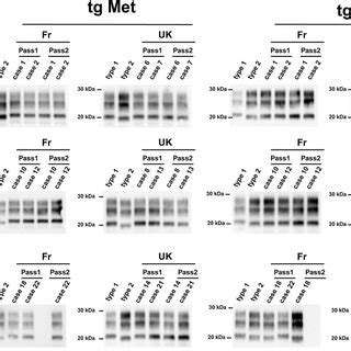 Prp Res Western Blot Profiles In The Brains Of Human Prp Expressing