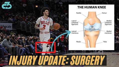 Lonzo Ball Injury Update Expert Explains Knee Surgery Timeline