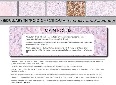 Thyroid Medullary Carcinoma