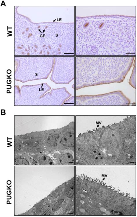 Muc1 And Microvilli In The Uterus A Immunohistochemical Localization