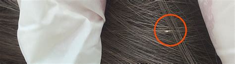 7 Facts About Head Lice Lice Treatment In Kamloops