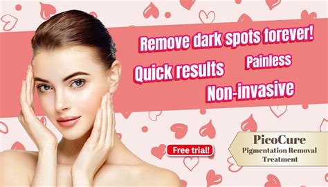 Spot Removal Cream Guide Flawless Skin Secrets Perfect Medical