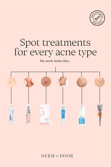 Top 10 Common Cause Of Acne And Treatments Artofit