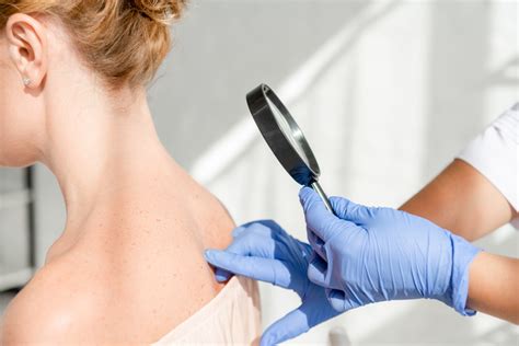 Become A Dermatology Nurse In 3 Steps Incredible Health