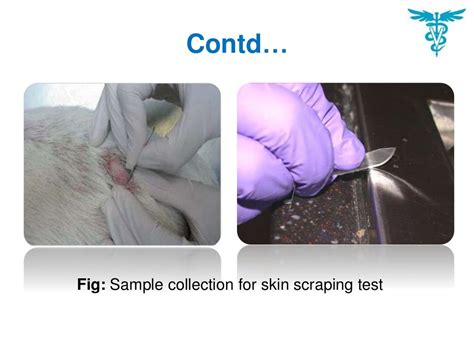 Skin scraping test