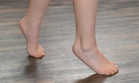 Toe Walking Treatment Pune | Dr. Chetan Oswal