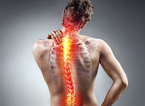 Slipped Discs And How Bowen Therapy Can Help Mybowen Therapy