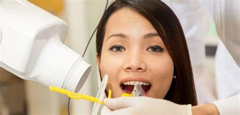 Dental Periapical X Rays Radiography Turkey Implant Cost Istanbul