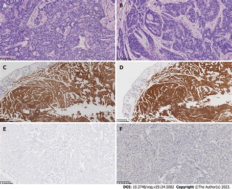 Hematoxylin Eosin Staining And Immunohistochemical Staining A And B