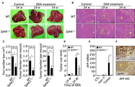 Deletion Of Sphingosine Kinase 1 Inhibits Liver Tumorigenesis In Diethylnitrosamine Treated Mice