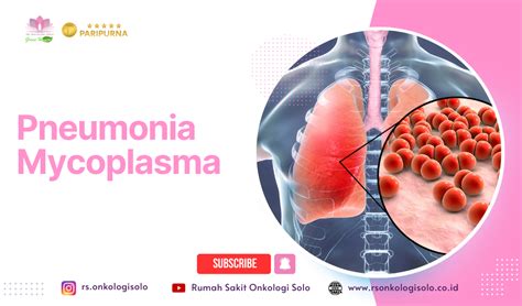 Apa Yang Kamu Ketahui Tentang Pneumonia Mycoplasma