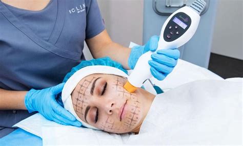 Thermage Flx Skin Tightening Thermage Skin Treatments Skin Tightening