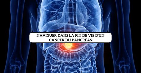 Naviguer Dans La Fin De Vie D Un Cancer Du Pancr As Silver Media