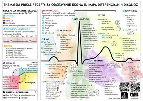 Printable 12 Lead Ekg Interpretation Cheat Sheet