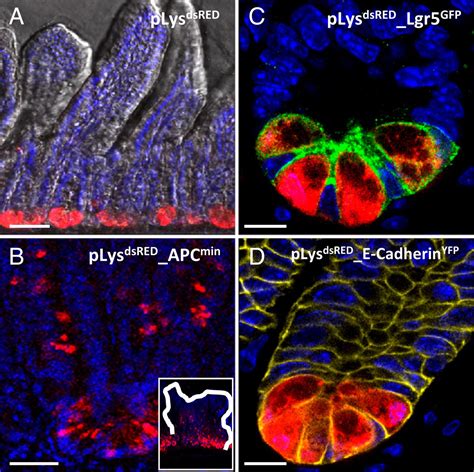 Paneth Cells