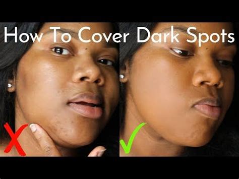 How To Cover Acne Dark Spots Hyperpigmentation Without A Lot Of Makeup