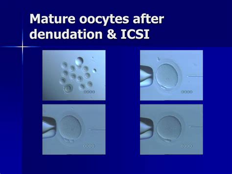 Ppt In Vitro Maturation Patient Selection And Results Powerpoint