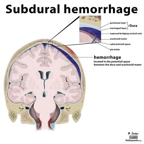 Pin On Medical Illustrations