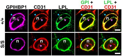 A Protein Of Capillary Endothelial Cells GPIHBP1 Is Crucial For