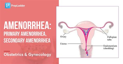 Amenorrhea Primary And Secondary Prepladder