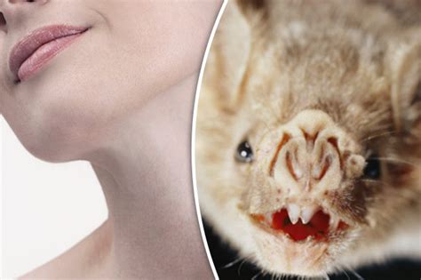 Brazils Vampire Bats Carrying Rabies Sinking Teeth Into Humans For