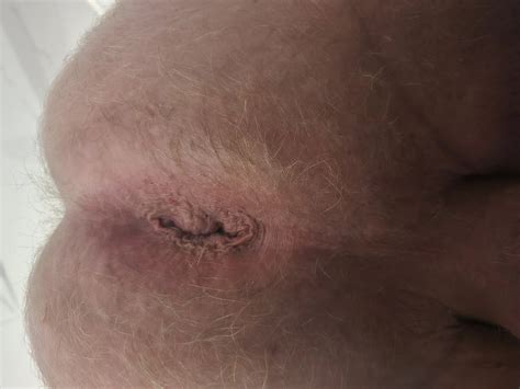 Working On My Gape 7 Nude Pics XHamster