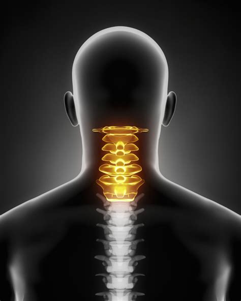 Anterior Cervical Discectomy And Fusion Procedure