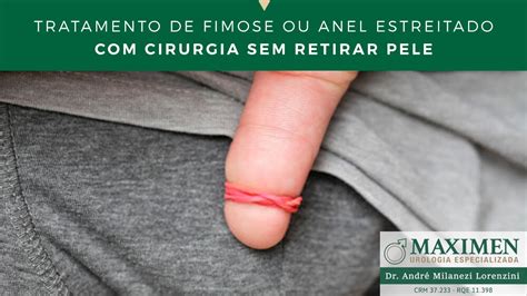 Como Tratar Fimose Ou Anel Estreitado Cirurgia Sem Retirar Pele