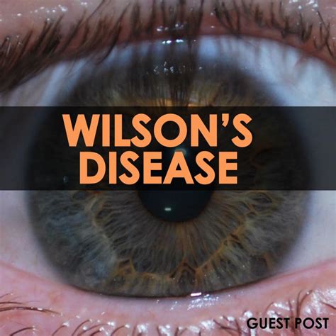 Wilson's Disease Causes and Symptoms