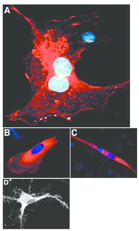 Myotubularin Is Cytoplasmic And Associated With Plasma Membrane A