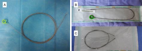 Figure From Correction Of Migrated Peritoneal Dialysis Catheter Using