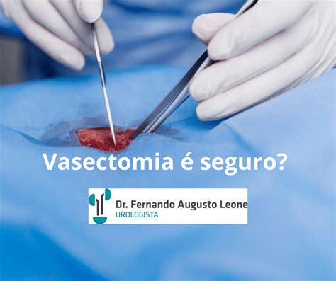 Vasectomia Seguro Dr Fernando Leone Urologista Bh Urologista Bh