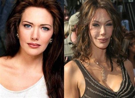 Deborah Jo Hunter Plastic Surgery Gone Wrong Plastic Surgery