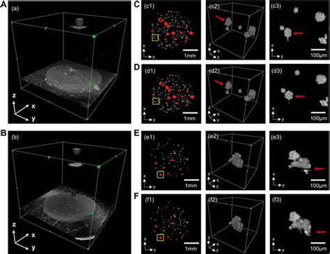 Frontiers Automated Detection And Growth Tracking Of 3d Bio Printed Organoid Clusters Using